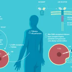 Illustration av hur immunterapi mot cancer fungerar: T-celler modifieras för att känna igen och döda cancerceller.