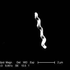 Elektronmikroskopisk bild av en spiralformad bakterie, potentiellt relevant för campylobacter behandling.