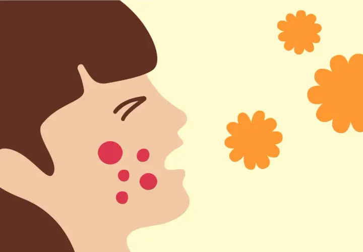 Ansiktsillustration med utslag, kanske från ett pissmyra bett. Orange blommor svävar i luften.