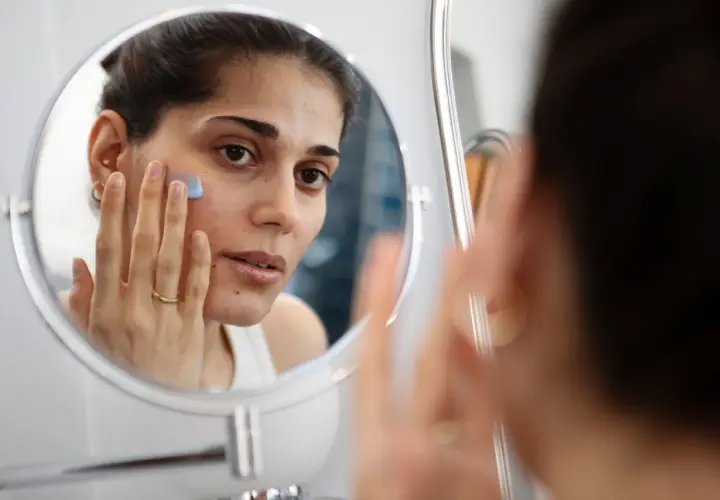 Kvinna applicerar en blå kräm i ansiktet framför spegeln, en del av hennes hudvårdsrutin för ansiktsbehandling mot acne.
