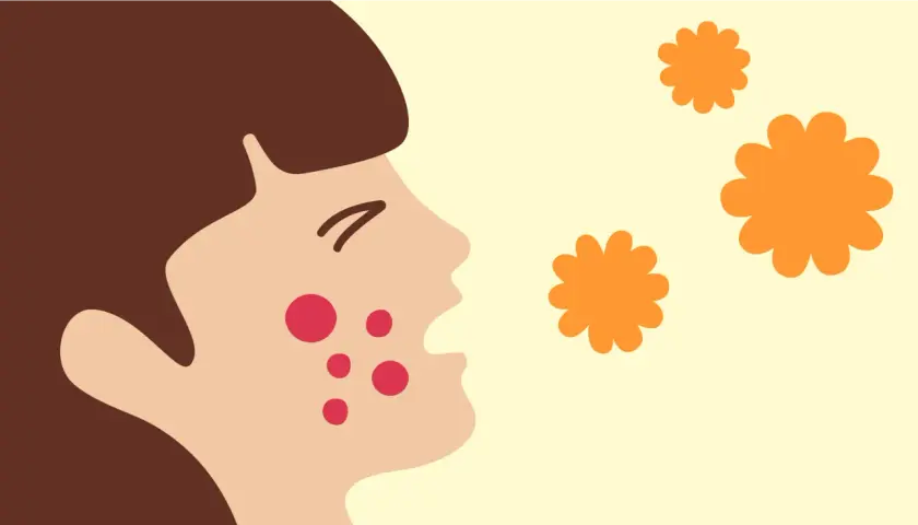Ansiktsillustration med utslag, kanske från ett pissmyra bett. Orange blommor svävar i luften.