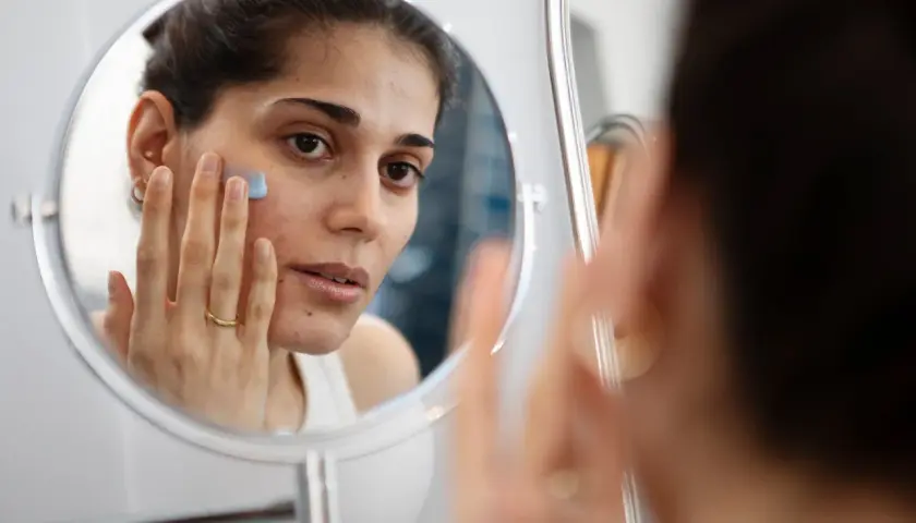 Kvinna applicerar en blå kräm i ansiktet framför spegeln, en del av hennes hudvårdsrutin för ansiktsbehandling mot acne.