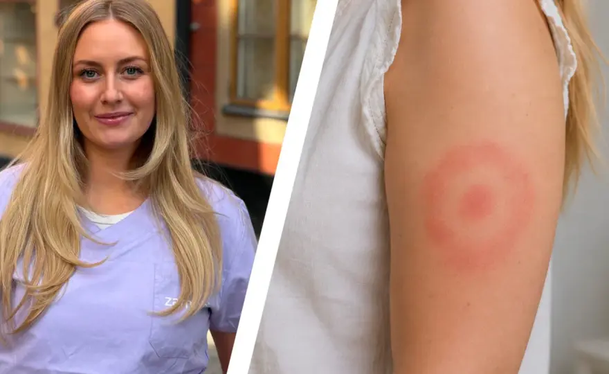 Borrelia i Sverige - så känner du igen tecknen och skyddar dig