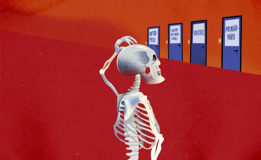 Biverkningar vid osteoporosbehandling - det här är vanligast