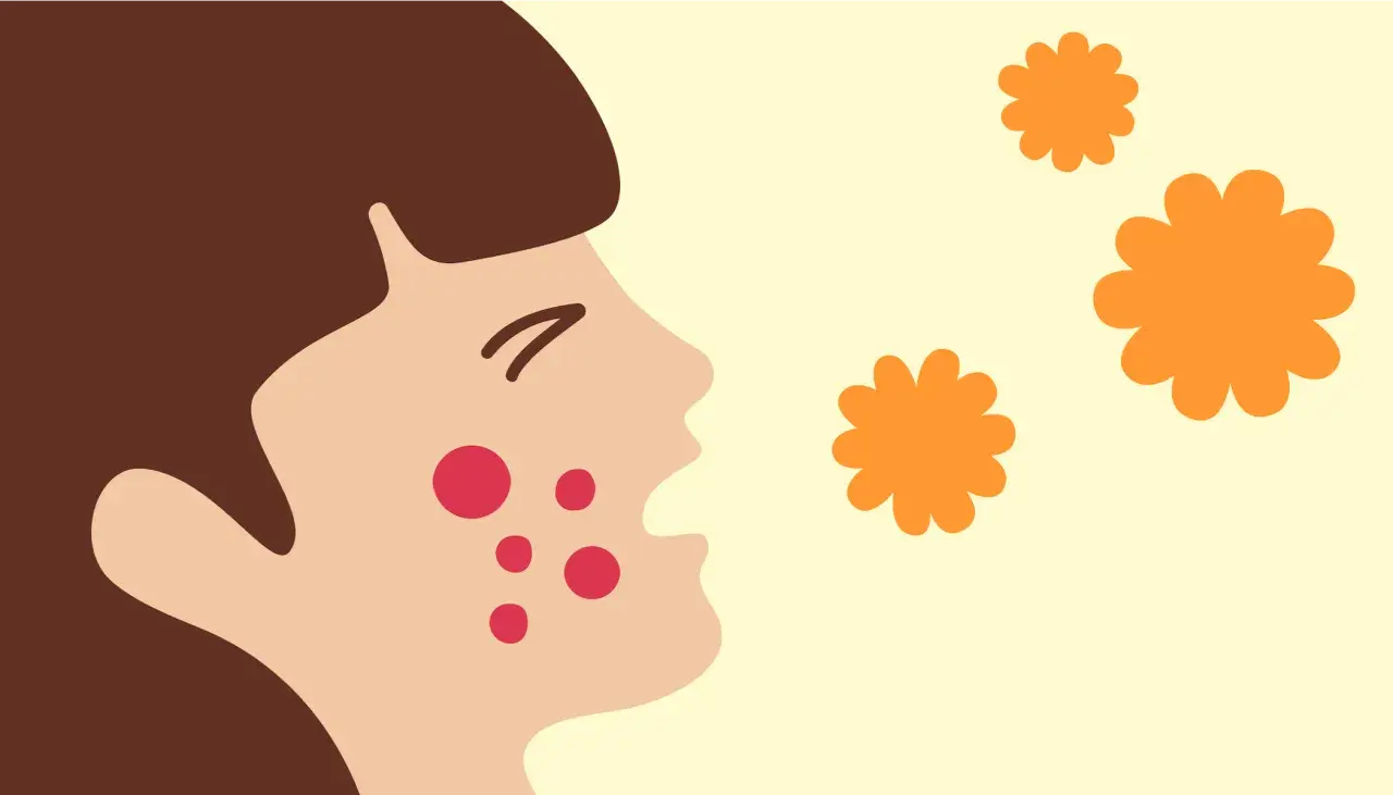 Ansiktsillustration med utslag, kanske från ett pissmyra bett. Orange blommor svävar i luften.