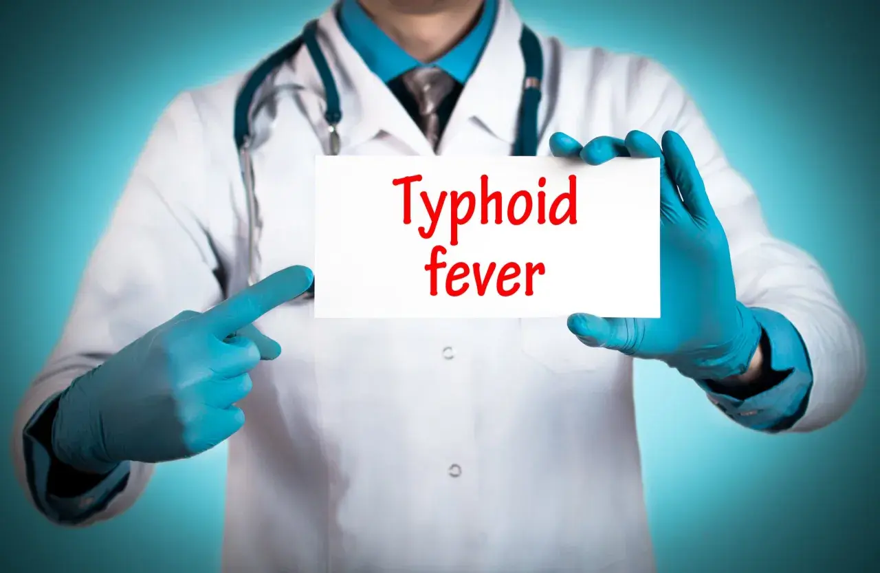 Läkare med blå handskar håller upp en skylt med texten "Typhoid fever". Snabb tyfus behandling är avgörande.