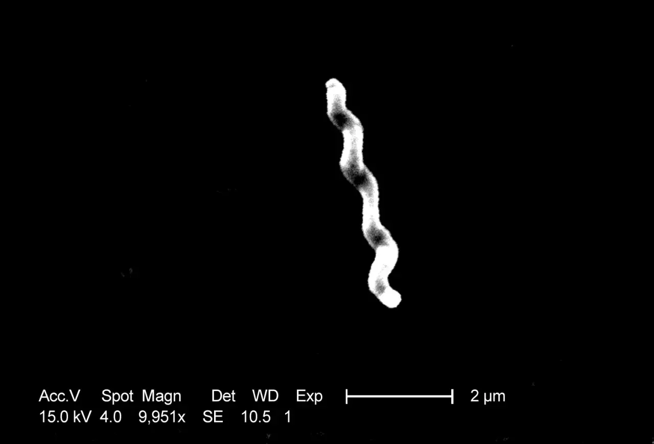 Elektronmikroskopisk bild av en spiralformad bakterie, potentiellt relevant för campylobacter behandling.