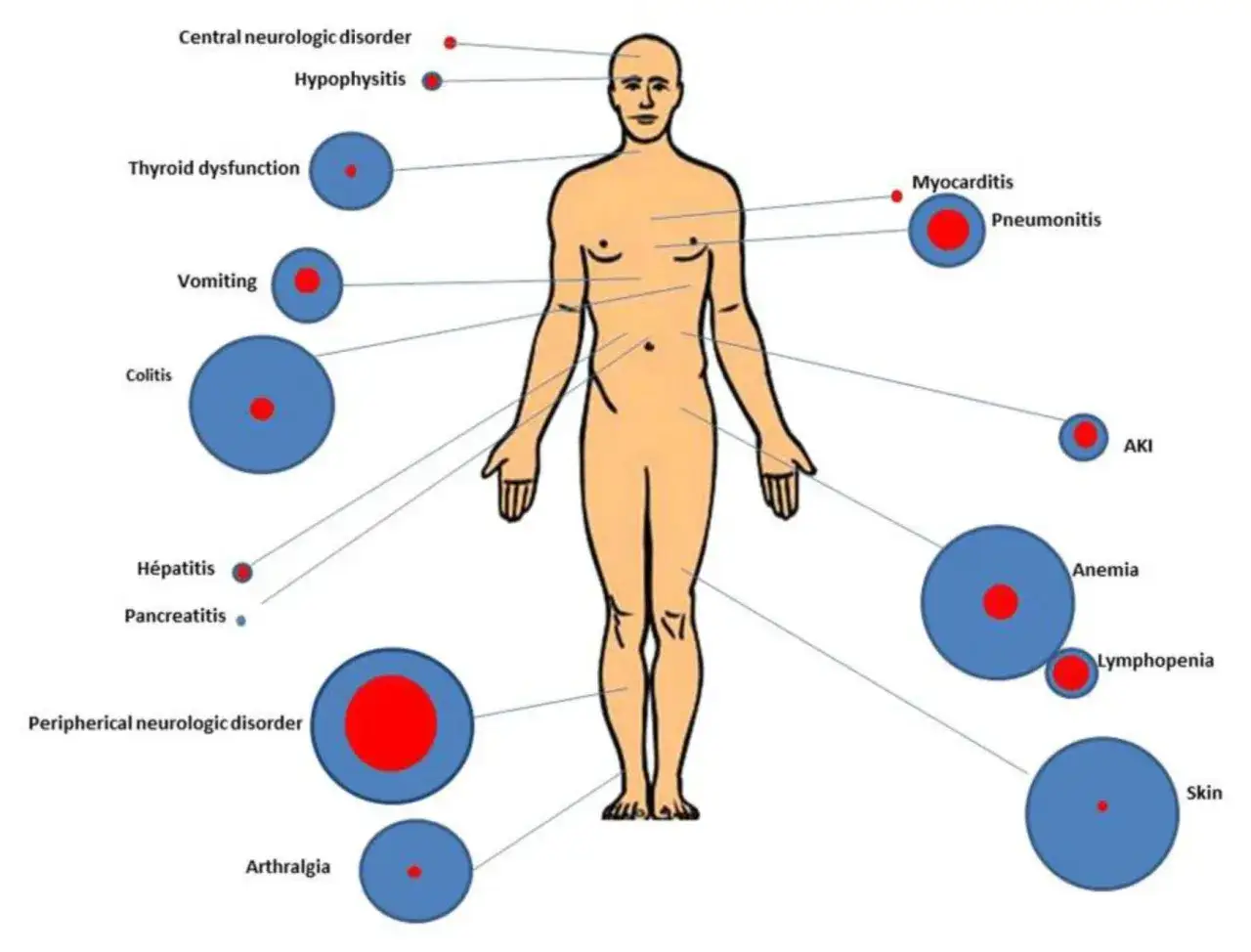 Diagrammet visar potentiella immunterapi biverkningar p&aring; olika organ, fr&aring;n hj&auml;rnan till huden.
