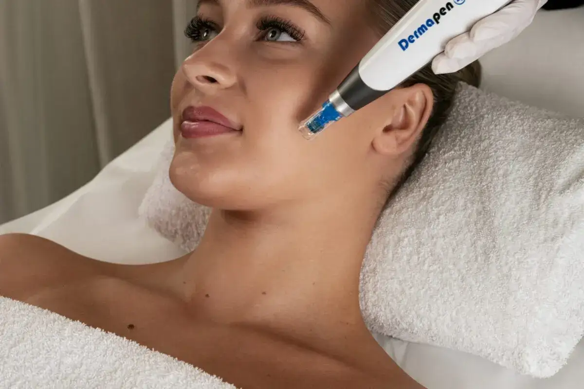 En kvinna f&aring;r en behandling med Dermapen4 f&ouml;r en ungdomligare hud.