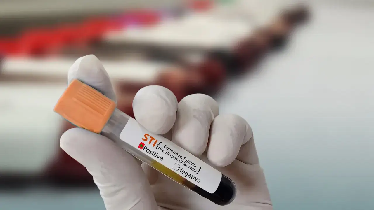 Hand in glove holds test tube showing positive result for STIs, including syphilis. Snabb syfilis behandling &auml;r viktig.