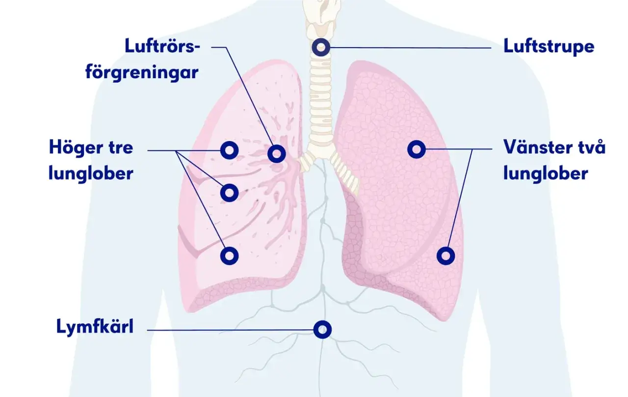 Illustration av lungor med luftstrupe, bronker, lunglober och lymfkärl. För att veta om man har lunginflammation kan man behöva undersöka dessa delar.